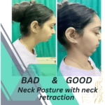 Physical therapy for neck pain