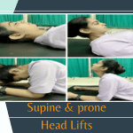 Exercise for Cervical Pain