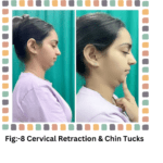 Exercise for Cervical Pain